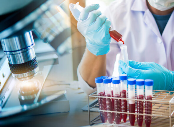 lab technician assistant analyzing a blood sample in test tube a